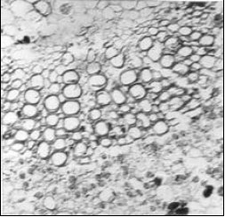 Image for - Micro-morphological Studies of Potash Affected Cotton Leaf