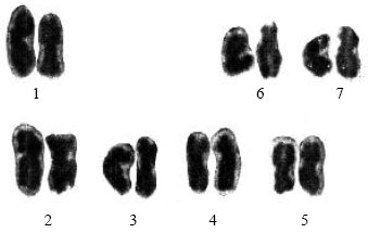 Image for - Karyotype Analysis of Some Legume Species (Vicia noeana Boiss. and Lathyrus sativus L.) Collected From Native Vegetation