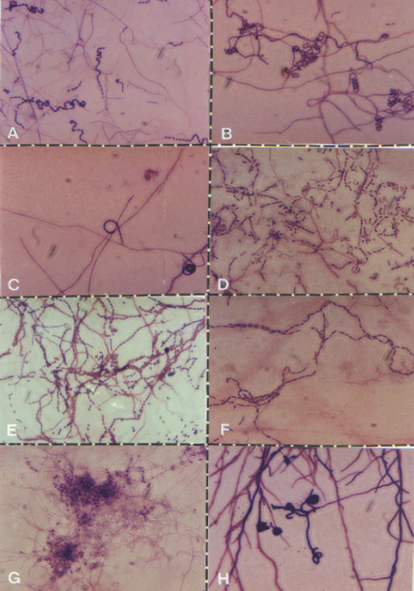 Image for - The Occurrence and Distribution of Soil Actinomycetes in Saint Catherine Area, South Sinai, Egypt
