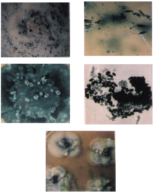 Image for - Prevalence and Pathogenicity of Guava Anthracnose with Special Emphasis on Varietal Reaction
