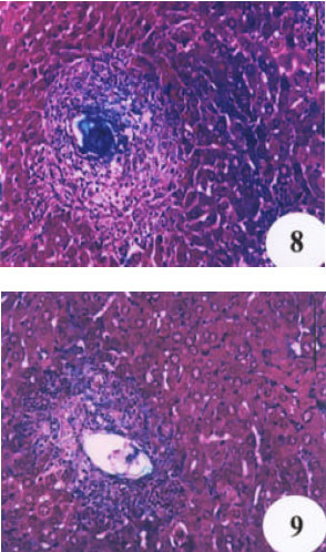 Image for - Evaluation of the Protective Effect of Two Antioxidative Agents in Mice Experimentally Infected with Schistosoma mansoni: Haematological and Histopathological Aspects