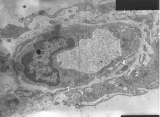 Image for - Enclothelial Cell Toxicity of Cadmium: Transmission Electron Microscopy Examination