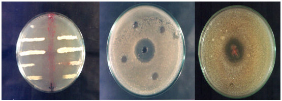 Image for - Isolation, Identification and Bacteriocin Production by Indigenous Diseased Plant and Soil Associated Bacteria