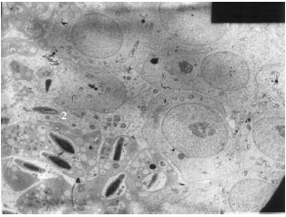 Image for - Enclothelial Cell Toxicity of Cadmium: Transmission Electron Microscopy Examination