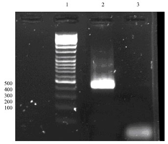 Image for - Isolation of Iranian Human Papillomavirus Type 16 E6 Gene and Construction of its Cloning Vector