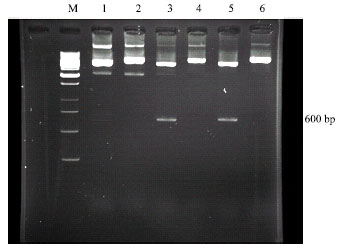 Image for - Isolation of Iranian Human Papillomavirus Type 16 E6 Gene and Construction of its Cloning Vector