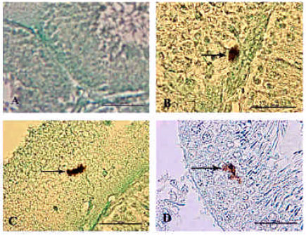 Image for - Morphometric Changes of Rat Testis after Subchronic Oral Lead Intoxication and D-Penicillamine Treatment