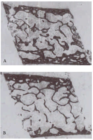 Image for - Comparison of Cancellous Bone Histomorphometry Between Young Men and Women