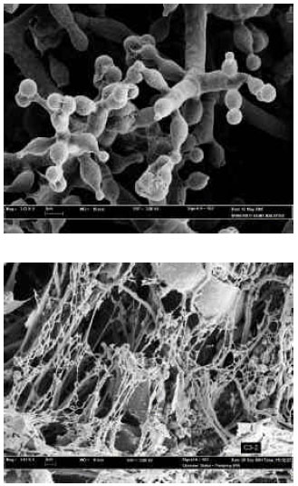 Image for - Production of Cellullolytic Enzymes by a Newly Isolated, Trichoderma sp. FETL c3-2 via Solid State Fermentation Grown on Sugar Cane Baggase: Palm Kernel Cake as Substrates