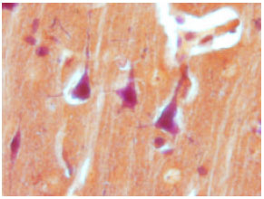 Image for - Estimation of Astrocyte Number in Different Subfield of Rat Hippocampus