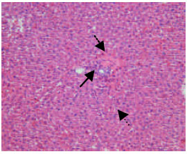 Image for - Histopathologic Changes of Rat Liver Following Formaldehyde Exposure