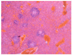Image for - Histopathology and Pathogenesis of Listeriosis Caused by Listeria monocytogenes Isolated from Raw Milk in Mice