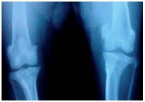 Image for - Changes in the Haematobiochemical Parameters in Experimental Stifle Osteoarthritis in Dogs