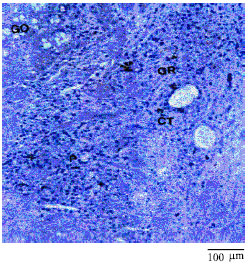 Image for - Histopathological and Histochemical Studies of Gut of Mouse During Schistosoma mansoni and Schistosoma margrebowiei Infections