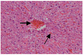Image for - Histopathologic Changes of Rat Liver Following Formaldehyde Exposure
