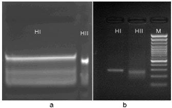 Image for - Cloning and Expression of Two Genes Encoding Subunits of Echinococcus granulosus Antigen B.