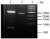 Image for - Cloning and Characterization of Serine-rich Entamoeba histolytica Protein Gene from an Iranian E. histolytica Isolate