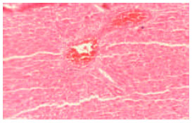 Image for - Toxicity Effect of Zinc Supplementation on the Liver Tissue