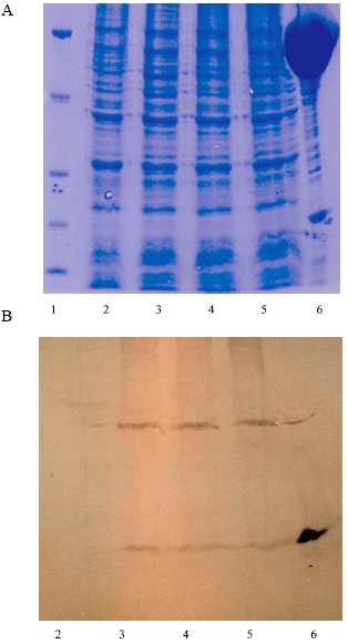 Image for - Design, Construction and Expression of a Synthetic β-Interferon (IFN-β) Gene in E. coli