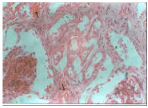 Image for - Pathology of Experimental Trypanosoma evansi Infection in Savannah Brown Buck