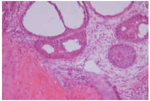 Image for - Pleural Mesothelioma in a Sheep