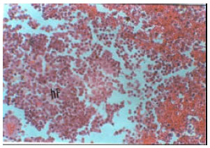 Image for - Pathology of Experimental Trypanosoma evansi Infection in Savannah Brown Buck