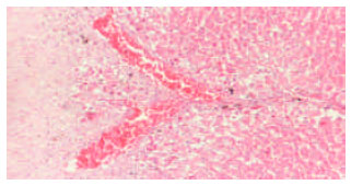 Image for - Toxicity Effect of Zinc Supplementation on the Liver Tissue