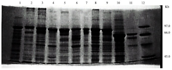 Image for - Cloning and Characterization of New emm Allele of Streprococcus pyogenes Strains Isolated in Kingdom of Saudi Arabia