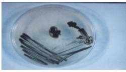 Image for - Contamination of Soft Contact Lenses and Their Storage Cases with Fungi: A Problem Which Causes Fungal Keratitis