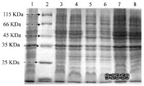 Image for - Cloning and Expression of Two Genes Encoding Subunits of Echinococcus granulosus Antigen B.