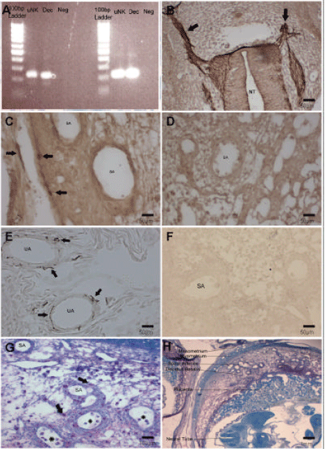 Image for - Are Natural Killer Cells Distributed in Relationship to Nerve Fibers in the Pregnant Mouse Uterus?