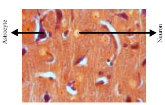 Image for - The Similarity of Astrocytes Number in Dentate Gyrus and CA3 Subfield of Rats Hippocampus