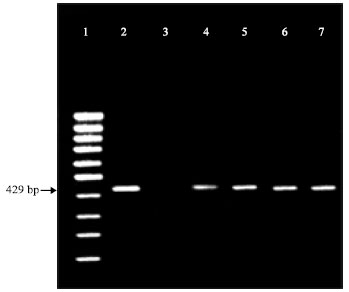 Image for - Detection of Ureaplasma urealyticum in Semen of Infertile Men by PCR