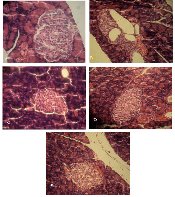 Image for - The Effect of Equisetum arvense L. (Equisetaceae)  in Histological Changes of Pancreatic β-Cells in Streptozotocin-Induced  Diabetic in Rats