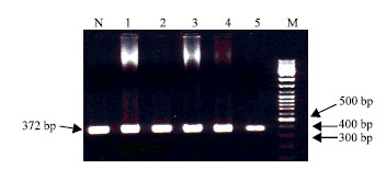 Image for - Identification of a Novel Missense Mutation in Exon 4 of the Human Factor VIII Gene Associated with Sever Hemophilia a Patient