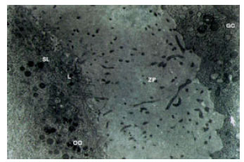 Image for - Ultrastructural Alterations and Occurrence of Apoptosis in Developing  Follicles Exposed to Low Frequency Electromagnetic Field in Rat Ovary