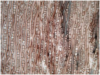 Image for - Ratio of Fusiform and Ray Initials in the Vascular Cambium of Madhuca indica J.F. Gmel