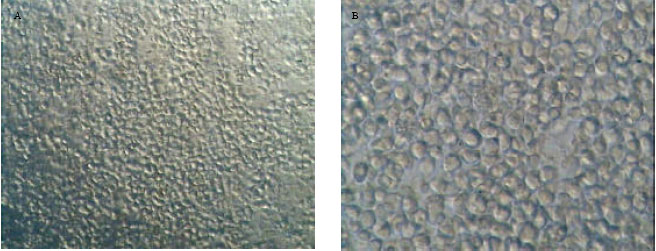 Image for - Evaluation of the Homing of Human CD34+ Cells in Mouse  Bone Marrow Using Clinical MR Imaging