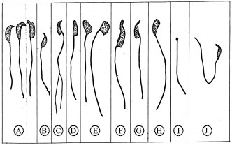 Image for - An in vivo Evaluation of Induction of Abnormal Sperm Morphology by Ivermectin MSD (Mectizan®)