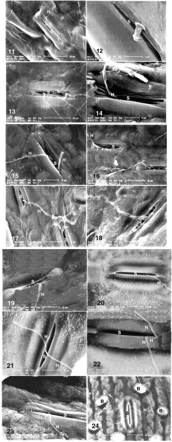 Image for - Ultrastructural Studies on Penetration Sites of Neovossia indica, the Partial Bunt Agent of Wheat