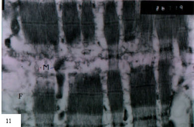 Image for - Electron Microscopic Studies on the Effect of the Diazepam on Mouse Sartorius Muscle