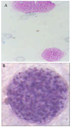 Image for - Isolation of Toxoplasma gondii from Horse Meat in Egypt