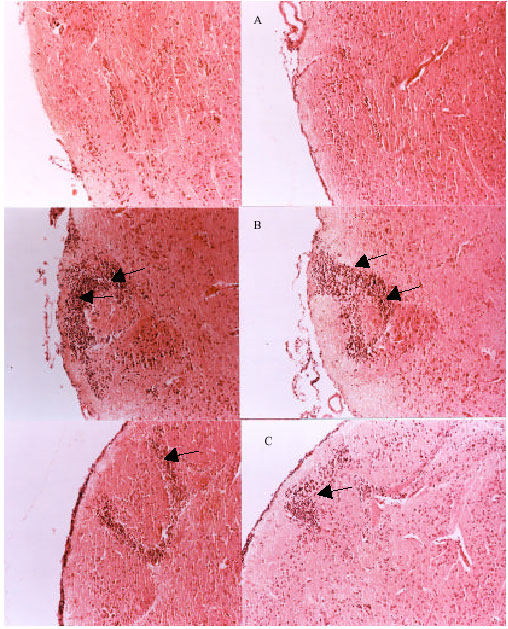 Image for - Effect of Sesame Oil on the Inhibition of Experimental Autoimmune Encephalomyelitis in C57BL/6 Mice