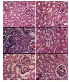 Image for - Protective Effect of Nigella sativa Seeds Against Lead-induced Hepatorenal Damage in Male Rats