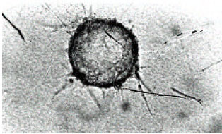 Image for - Anti- Plasminogen Monoclonal Antibody (MC2B8) Inhibites Angiogenesis