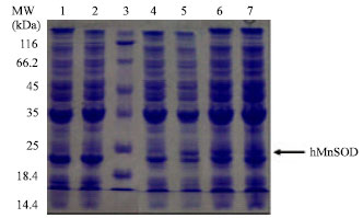 Image for - Cloning of Active Human Manganese Superoxide Dismutase and its Oxidative Protection in Escherichia coli