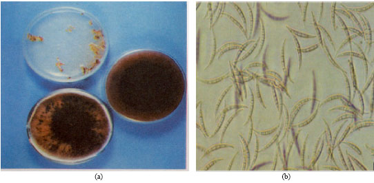 Image for - Incidence of Crown Rot Disease of Wheat Caused by Fusarium pseudograminearum as a New Soil Born Fungal Species in North West Iran