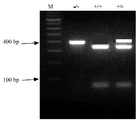 Image for - Restriction Fragment Length and Single Strand Conformational Polymorphisms in Chicken Mitochondrial Phosphoenol-Pyruate Carboxykinase Gene and its Association with Egg Production