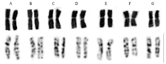 Image for - Karyotype and C-banding Patterns of Mitotic Chromosomes in Heteranthelium piliferum