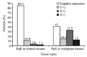 Image for - Progesterone Receptor Positive Colorectal Tumors Have Lower Thymidine Phosphorylase Expression: An Immunohistochemical Study